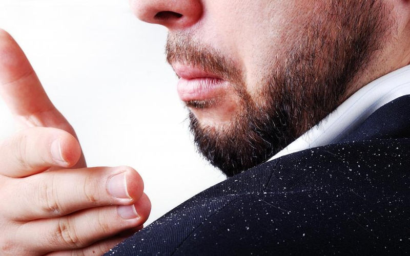 Hai la Forfora e non sai cosa è? Allora leggi qui